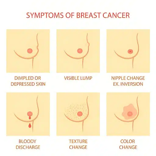 Signs of breast cancer