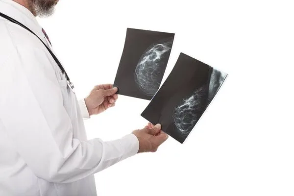 Breast Xray